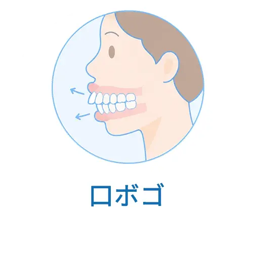 口ゴボ
