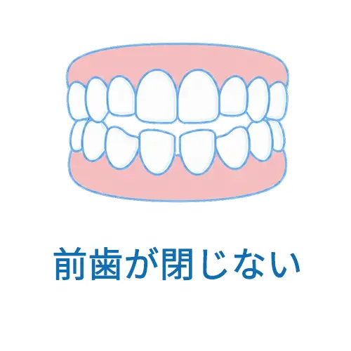 前歯が閉じない